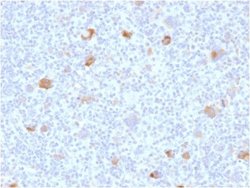 bcl-x Antibody (BCL2L1/2406) - Azide and BSA Free, Novus Biologicals 100
